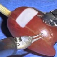 Surgery on a Grape from among us