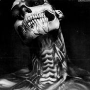 Vermize
