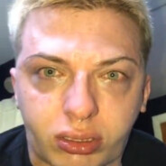 reffex