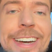 Mr. Beast's Teeth