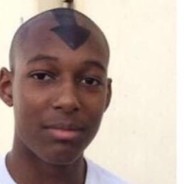Balltumor79-