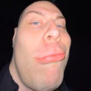 scraz