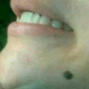 LMZIE