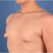 Mr.Nippelmann