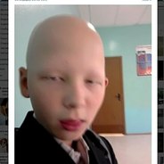 Лысый
