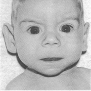 hs machine de neuhausen