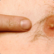 MY NIPPLES ARE ASYMMETRICAL
