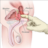 Prostate Secretions's Avatar