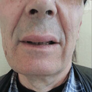 Harold