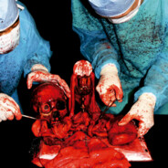 CarcaSS