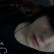 [eysye]~Bluterguss