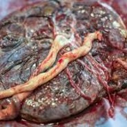 Mutterkuchen's Avatar