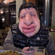 ПАДЛА НИЩАЯ