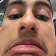PeDiCK