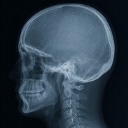 Steam profile avatar of RaioX