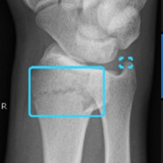 Thorooth